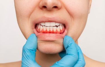 Periodontia